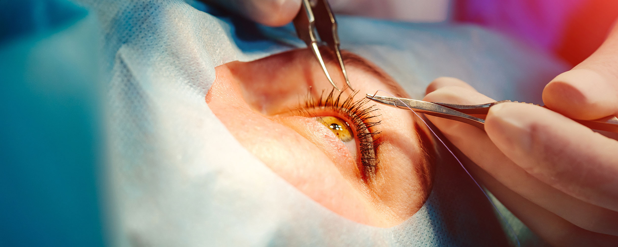 Doctor working on patients eye image